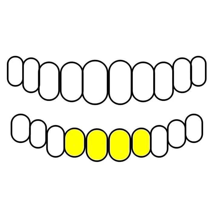 Bling Cartel Admin Rings Gold Plated over Solid 925 Sterling Silver Plain Custom Grillz