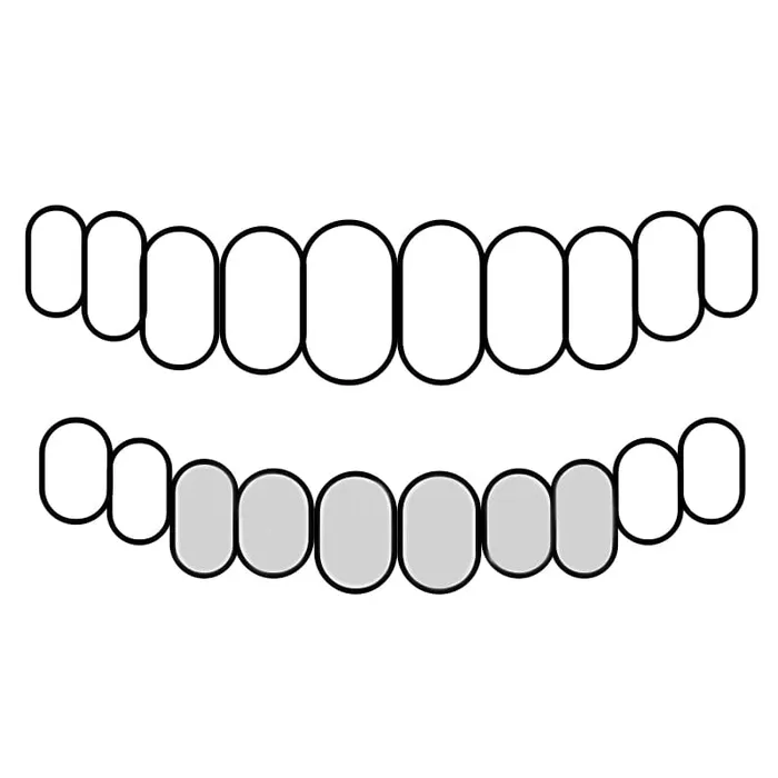PreStyled Sets Real 10K White Gold Diamond Dust wBorder Custom Grillz Bling Cartel Admin